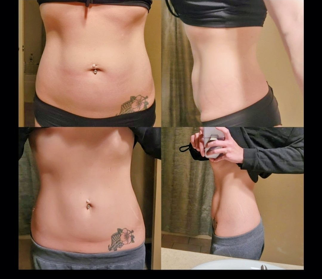 Christina's Personal Zerona Results